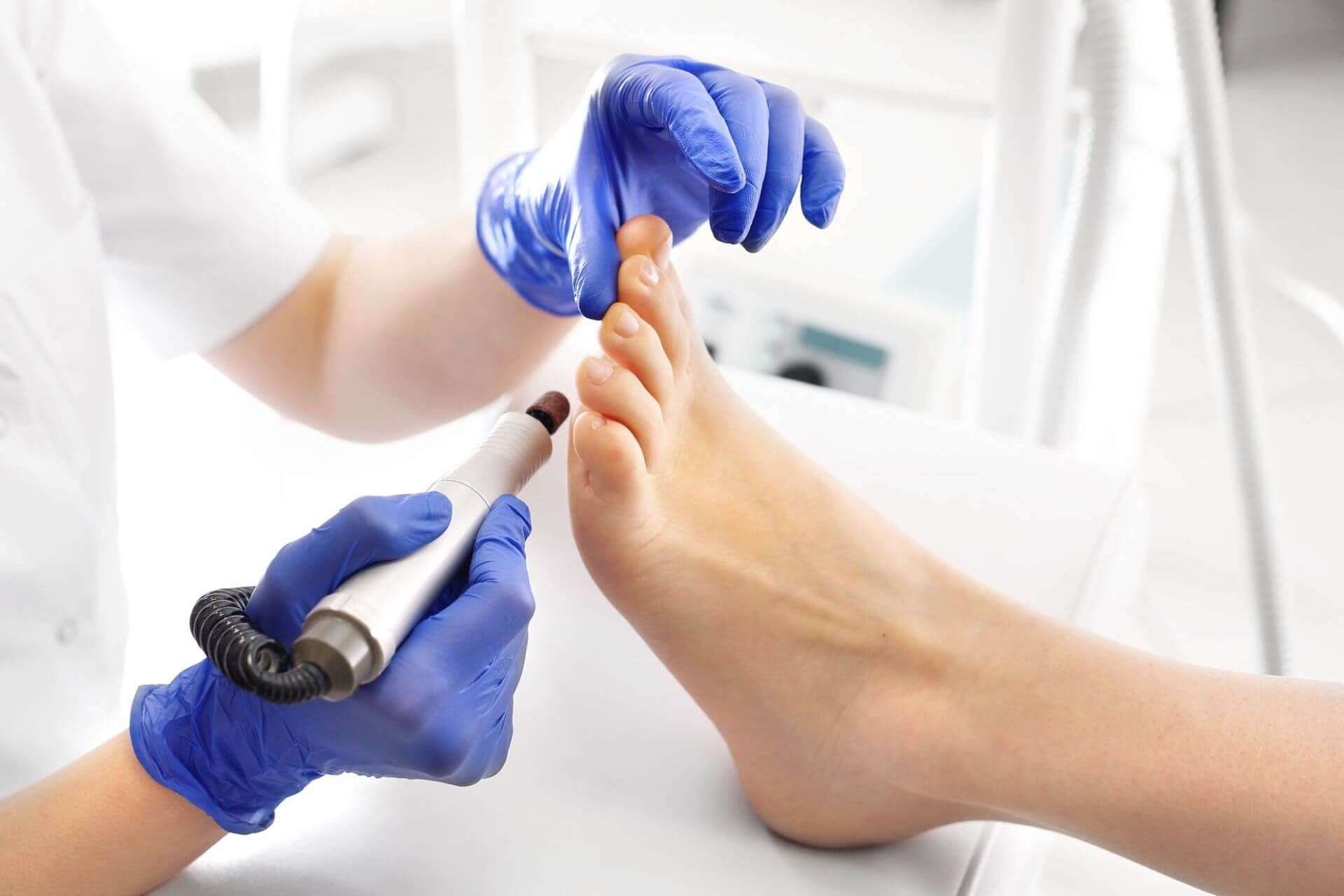 Behandlung bei verschiedenen Nagelproblemen: